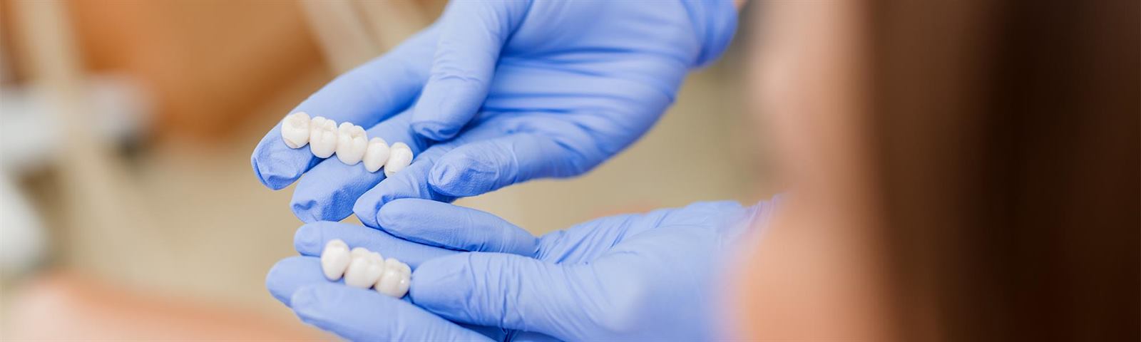 Porcelain crowns