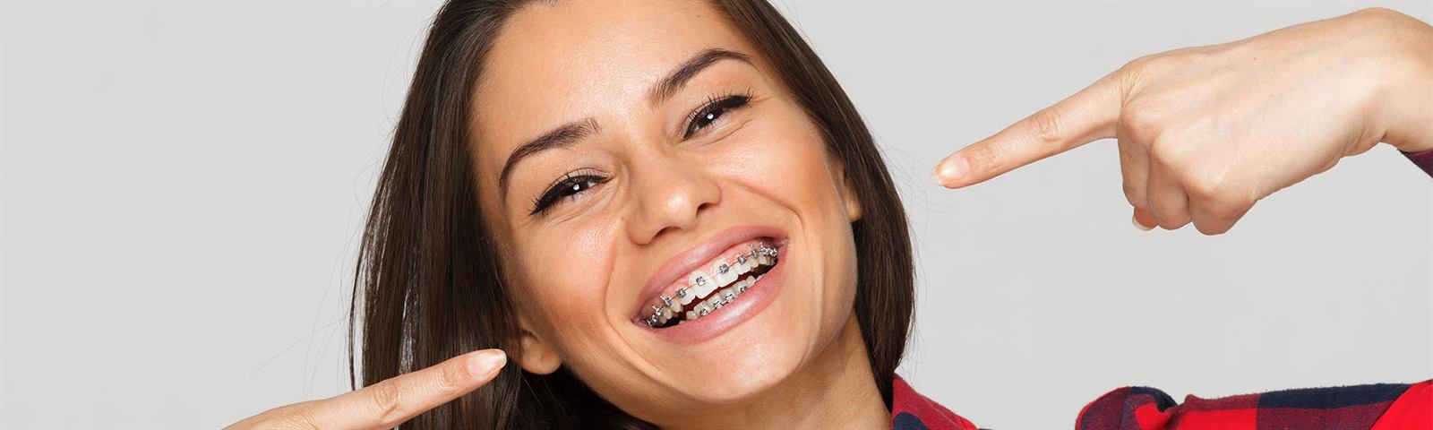 Metal braces