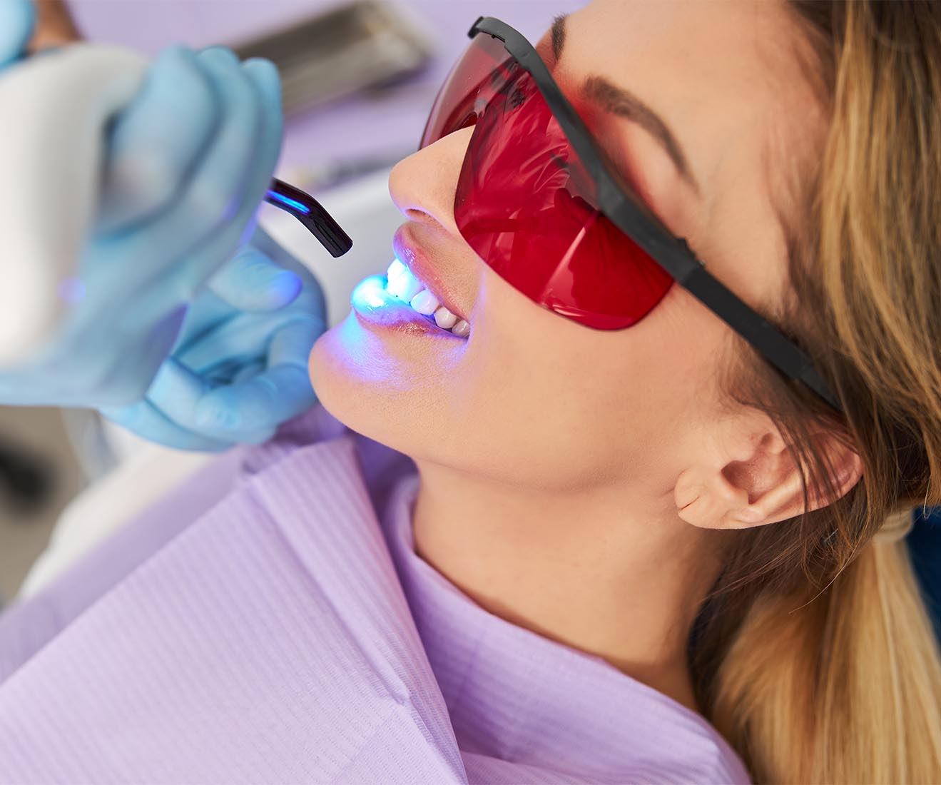 Teeth Whitening